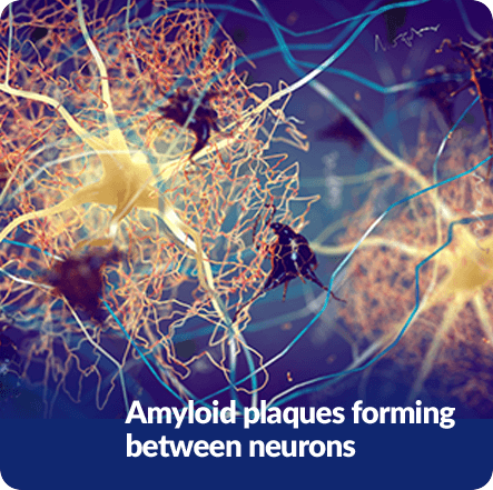 Anti-Amyloid Properties Of Fisetin's GenuinePurity