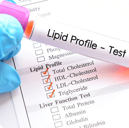 Lipid profile test Of Fisetin