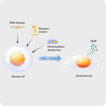 Understanding theSenolytic Role of Fisetin