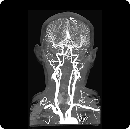 Blood Vessel Function - GenuinePurity Spermidine